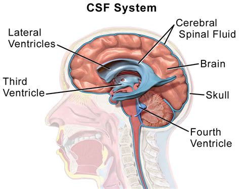 csf leak from nose test|Diagnosis of CSF Leak